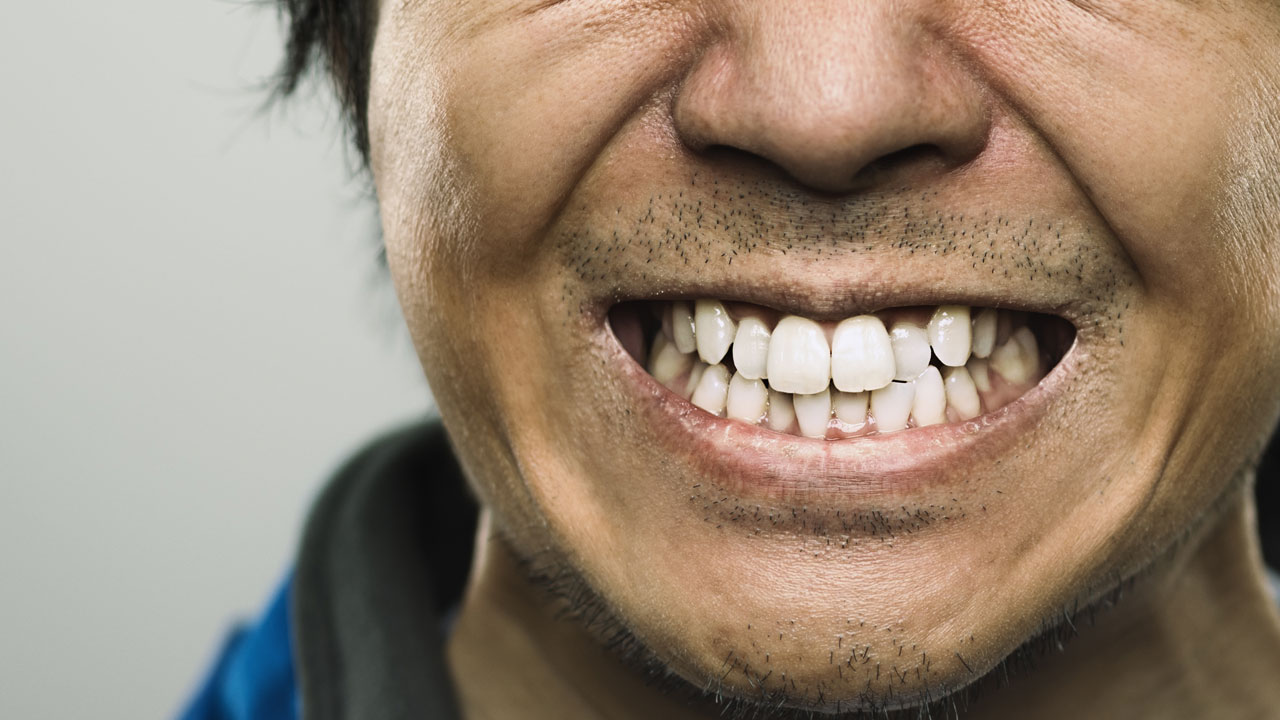 Zähne mit 30 schlechte Wie wichtig